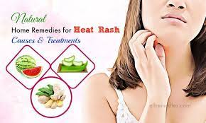 Home Remedies For Heat Rash Stomach Remedies Heat Rash Natural Home Remedies