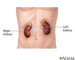 Kidney Removal Information Mount Sinai New York