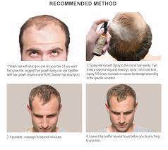 The lightweight formula offers a flexible, light hold that's strong enough to control frizz but won't plaster your hair to your scalp. Purc Hair Growth Spray Fast Growing Hair Oil Loss Treatment Thinning Preventing Hair Care Beauty Products 30ml For Men Women Hair Loss Products Aliexpress