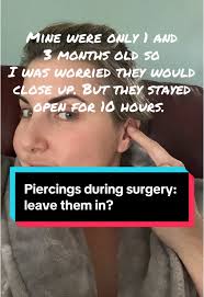 Why You Should Remove Piercings Before Surgery
