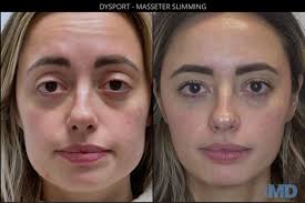 TOP 10 BEST Colonics in Methuen, MA