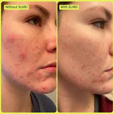 Dr Sandra Lee aka drpimplepopper