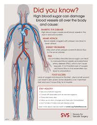 In serious cases, medical procedures or surgery can. Six Diabetes Related Vascular Complications And How To Avoid Them Society For Vascular Surgery