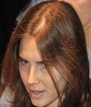 She is one of the very few celebritieswho have accepted hair loss and never attempted to cover it up.her hair loss, which was most likely caused by stress and hair extensions, was only a temporary problem. Hair Loss In Women The Balding Truth Beautyfeatures Ie