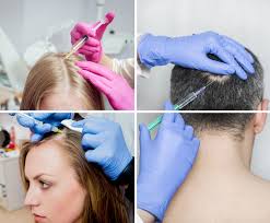 mesotherapie ablauf und kosten dortmund bochum essen mesotherapie