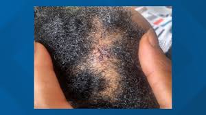 Clean the wound with tap water. High Point Toddler Grazed By Bullet After Shots Fired Into Home Wfmynews2 Com