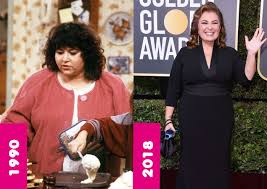 roseanne barr weight loss gastric