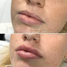 About — Fiona McEwan Cosmetic Nurse