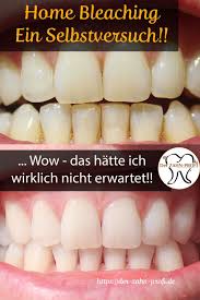 Für einen möglichst hohen home bleaching erfolg ist eine professionelle zahnreinigung vor bleaching beginn angezeigt. Pin Auf Diet