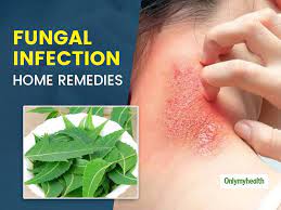 Fungal Skin Infection Bothering You? Here Are 5 Home Remedies To Get Rid Of  It - Fungal Skin Infection Bothering You? Here Are 5 Home Remedies To Get  Rid Of It