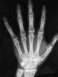 10 trivia questions, rated average. 01 X Ray Tech Review Bank Test Proprofs Quiz