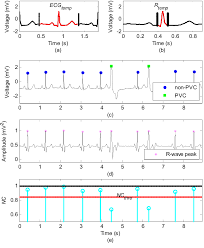 We are a local and honest concrete contractor specialized in all phases of concrete, comercial and residential, from broom. The Illustration Of The Ecg Template Construction And Pvc Recognition Download Scientific Diagram