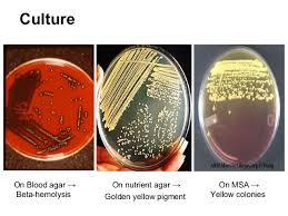 On blood agar plates, colonies of staphylococcus aureus fig. Staphylococci Prac Microbiology