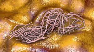 Image result for Pinworm