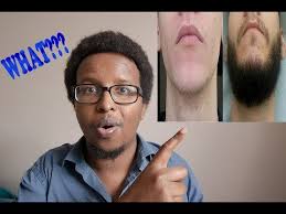 Here are some minoxidil beard before and after results! Regaine Rogaine For Beard Growth Before And After Results Youtube