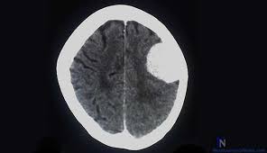 Pin On Neuroscience Articles