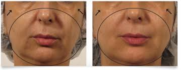Light years ahead of his earlier releases with regard to production techniques. The Oxygeneo Super Facial Terrell Clinic