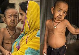The rare disorder has caused the tot to tragically age prematurely and. Meet The Benjamin Button Of Bangladesh Who Looks 80 But Is Just 4 Years Old Health Asia News Asiaone
