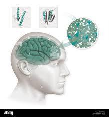 Cow brain hi-res stock photography and images