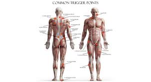 Image result for Trigger Point Location