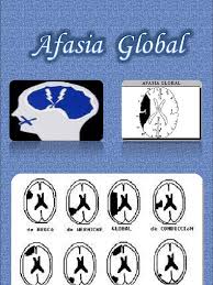Check spelling or type a new query. Afasia Global Terminada Afasia Cerebro