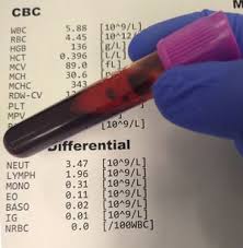 Check spelling or type a new query. Lab Value Interpretation Physiopedia