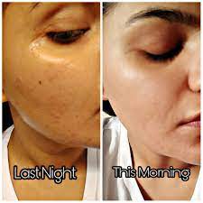 Rated 4 out of 5 on makeupalley. All In One Snail Repair Cream By Mizon Review Skin Eclat