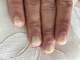 NAIL CLINIQUE