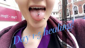 Tongue Piercing Healing Process Days 1 5 Youtube