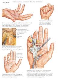 Pin On Anatomy