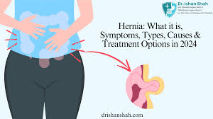 Image result for stomach hernia symptoms
