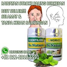 Sering kesemutan inilah tips menghilangkannya dr daniel bramantyo. Stroke Kebas Kaki Dan Tangan Ubat Dan Rawatan Berkesan Terbaik Solusi Sipilis
