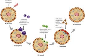 The normal bone remodeling is a process that couples bone resorption and bone formation, it activation of bone remodeling on the cancellous bone surfaces and activation of neighbouring bone. Bone Remodelling In Vitro Where Are We Headed A Review On The Current Understanding Of Physiological Bone Remodelling And Inflammation And The Strategies For Testing Biomaterials In Vitro Sciencedirect