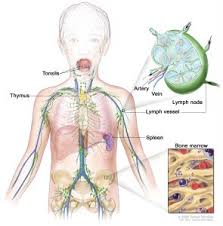 Pelajari tentang karakteristik dan perawatannya. Aplikasi Stem Cell Pada Limfoma Non Hodgkin