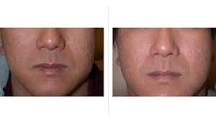 Image result for what is the best scar reducing treatment