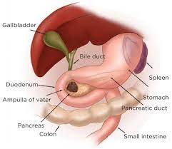 With so few advanced warnings, how can people stay vigilant about the potential for pancreatic cancer? Olaparib For Pancreatic Cancer With Brca Mutations National Cancer Institute