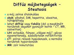 Maj Es Az Eperendszer Betegsegei Ppt Letolteni