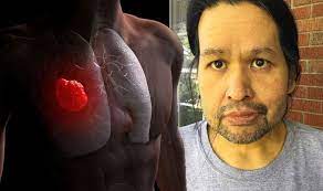 When malignant cancer cells form and grow within a person's breast tissue, breast cancer occurs. Lung Cancer Symptoms Signs Of Tumour Include Yellow Skin Or Eyes When To See A Doctor Express Co Uk