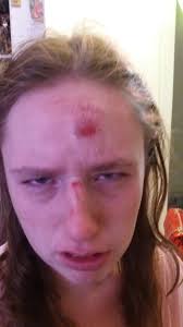 Autistic 19-year-old handcuffed and injured after run-in with La Quinta  police