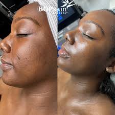 Small Business of the Day: Conversations with Monique Deville of Bird Of  Paradise Skin Therapy