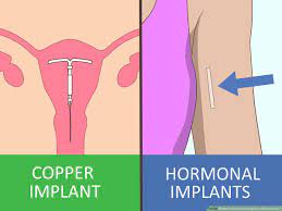 3 Ways To Not Gain Weight On Birth Control - Wikihow Life