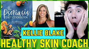 HOW SHE HEALED PSORIASIS W/KELLIE BLAKE (Founder of Nutrisense, Author: The  Psoriasis Diet Cookbook)