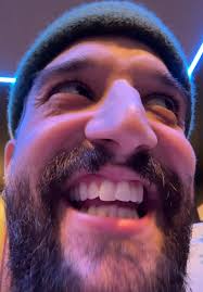 Mark Ballas Hair Explained