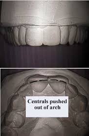 نتیجه جستجوی لغت [constricted] در گوگل