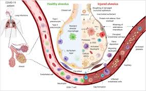 The Natural History Pathobiology And Clinical Manifestations Of Sars Cov 2 Infections Springerlink