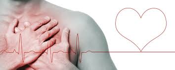 Parada cardiorrespiratória ( pcr 1 ) é o momento em que cessam os batimentos cardíacos e a pessoa para de respirar. O Que Fazer Diante De Uma Parada Cardiaca