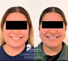 Clinica Dental Esperanza