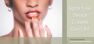 Becoz u need luting cement to fix a cap and u need to knw how to mix and the consistency of the mix. Signs That Your New Dental Crowns Don T Fit Vccid