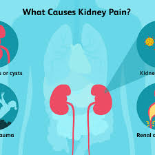 Your kidneys are in that location, protected by the ribs. Kidney Pain Causes Treatment And When To See A Doctor