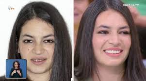 Marlene ganhou um novo sorriso com o «Portugal a Sorrir»